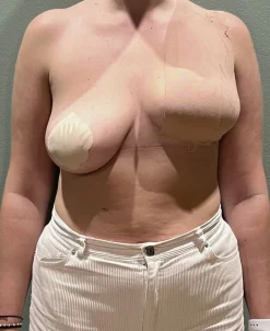 AISO Breast Tape 5cm Cholo New