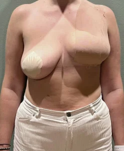 Dame AISO Breast Tape 5cm