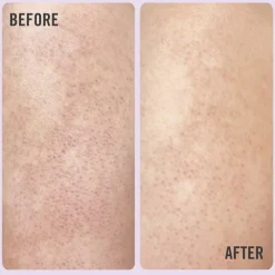 Sephora Collection DAILY ESSENTIALS KP BODY SCRUB 10%