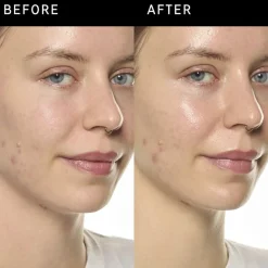 Ectoin Hydro-Barrier Serum - Fugtende og beskyttende serum>THE INKEY LIST Best