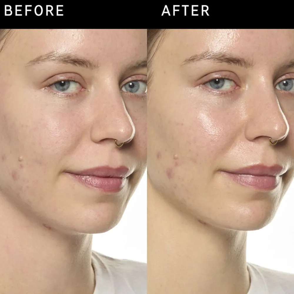 Ectoin Hydro-Barrier Serum - Fugtende og beskyttende serum>THE INKEY LIST Best