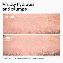 HYALURONIC ACID 2%�+ B5 30ML/1FLOZ><noscript><img width=