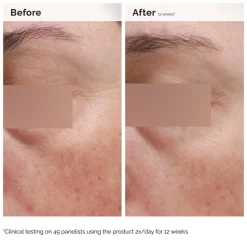 The Ordinary Niacinamide 5% Face and Body Emulsion