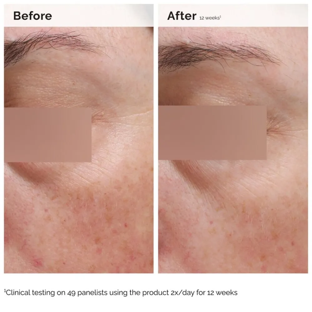 The Ordinary Niacinamide 5% Face and Body Emulsion