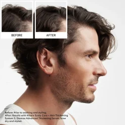 NIOXIN System 2 Loyalty Kit Hot