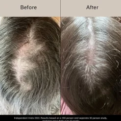 CHAMPO LIMITED Pitta vækstserum - Vækstserum