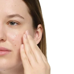 Salicylic Acid 2% Anhydrous Solution>The Ordinary Sale