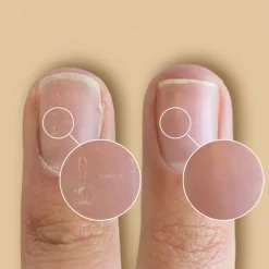 SolarOil Nail Care 14,78 ml.><noscript><img width=