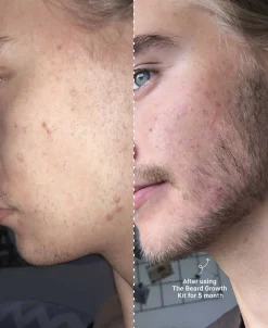 Copenhagen Grooming The Beard Growth Kit