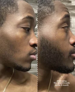 Copenhagen Grooming The Beard Growth Kit