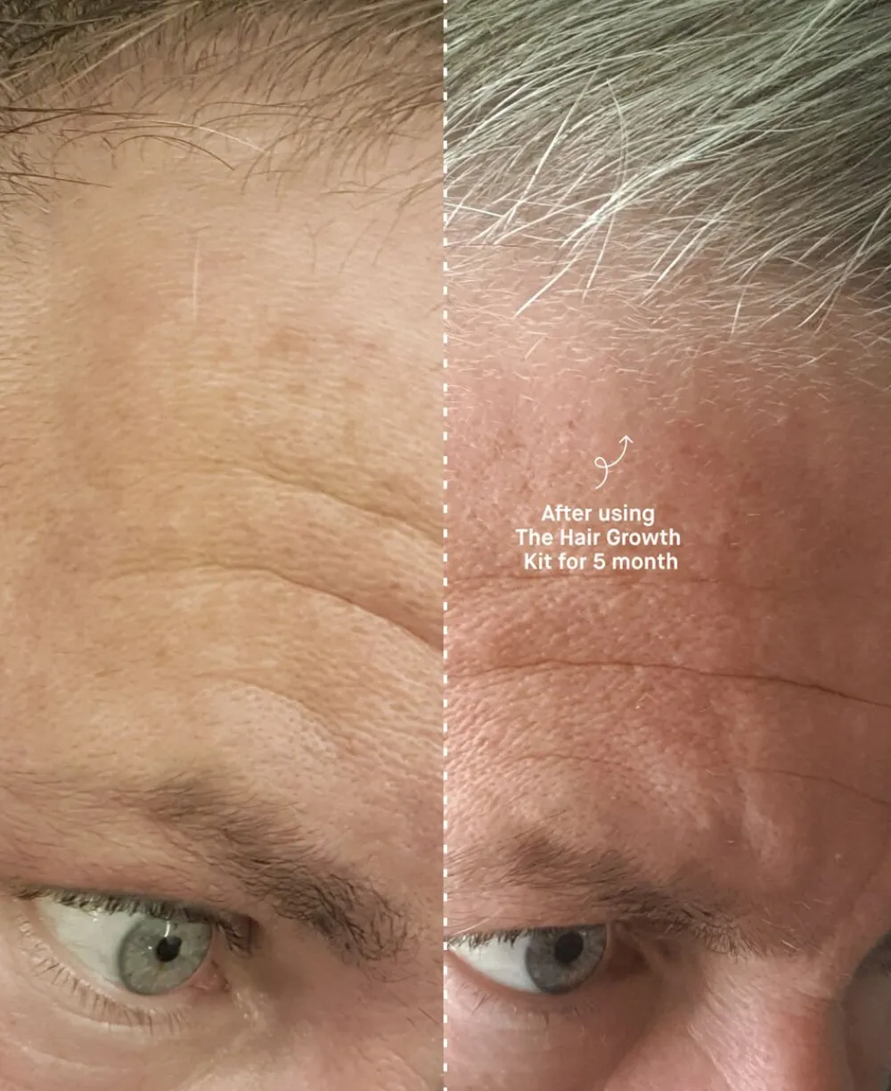 Copenhagen Grooming The Hair Growth Kit