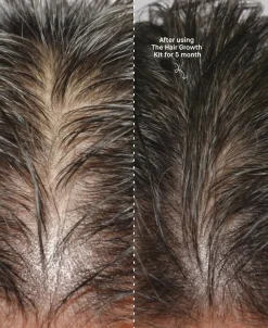 Copenhagen Grooming The Hair Growth Kit